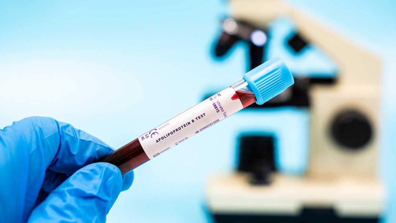 This heart health test spots risks better than cholesterol